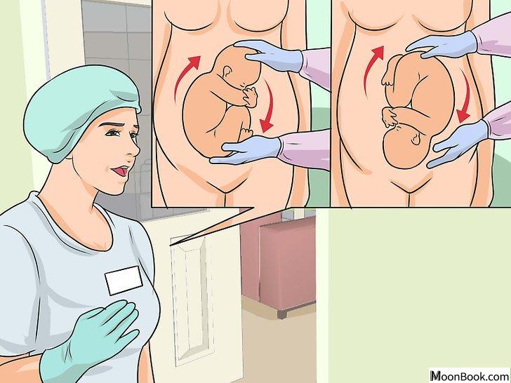 以Avoid a Cesarean Section Step 12为标题的图片