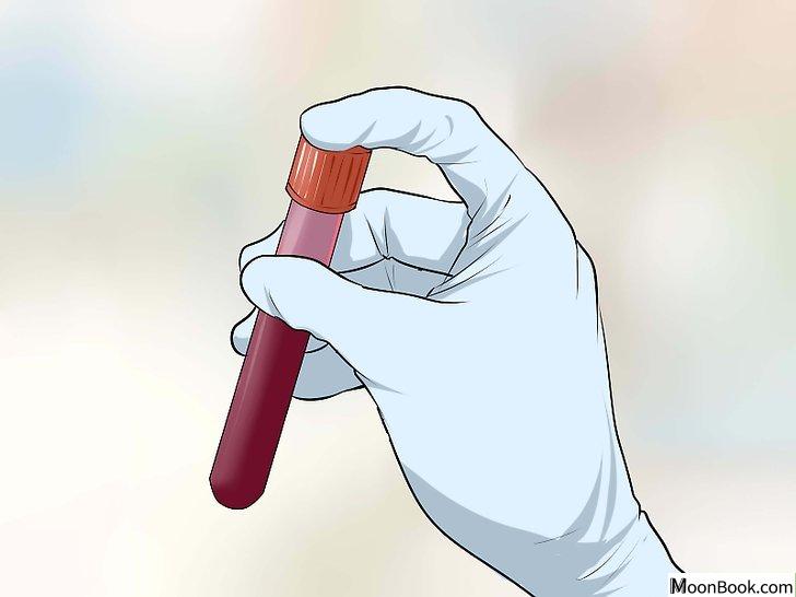 以Get Tested for STDs Without Letting Your Parents Know Step 4为标题的图片