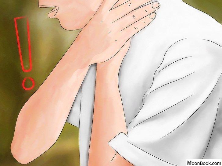 以Identify Insect Bites Step 12为标题的图片