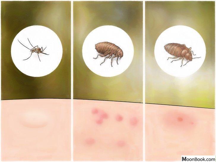 以Identify Insect Bites Step 2为标题的图片