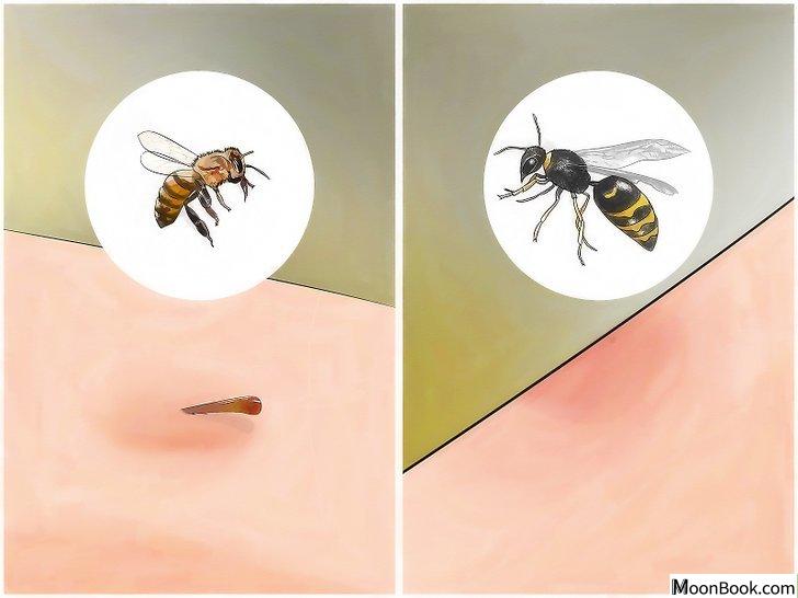 以Identify Insect Bites Step 4为标题的图片