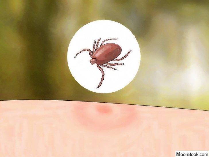 以Identify Insect Bites Step 5为标题的图片