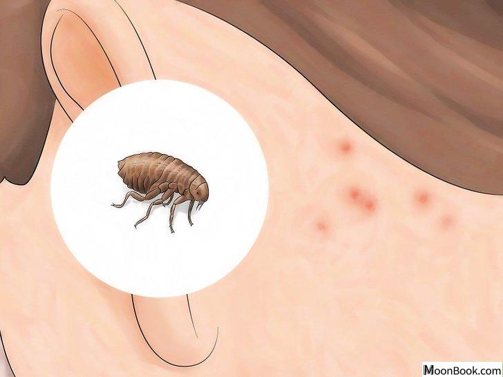 以Identify Insect Bites Step 6为标题的图片