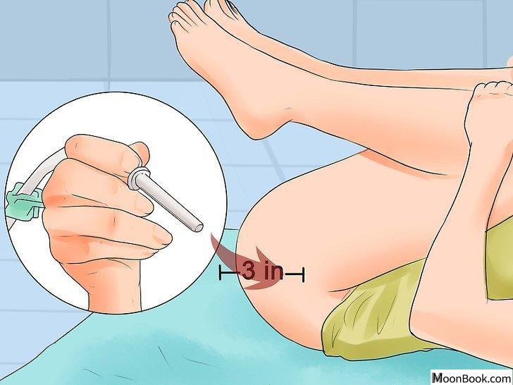 以Perform an Enema at Home Step 10为标题的图片