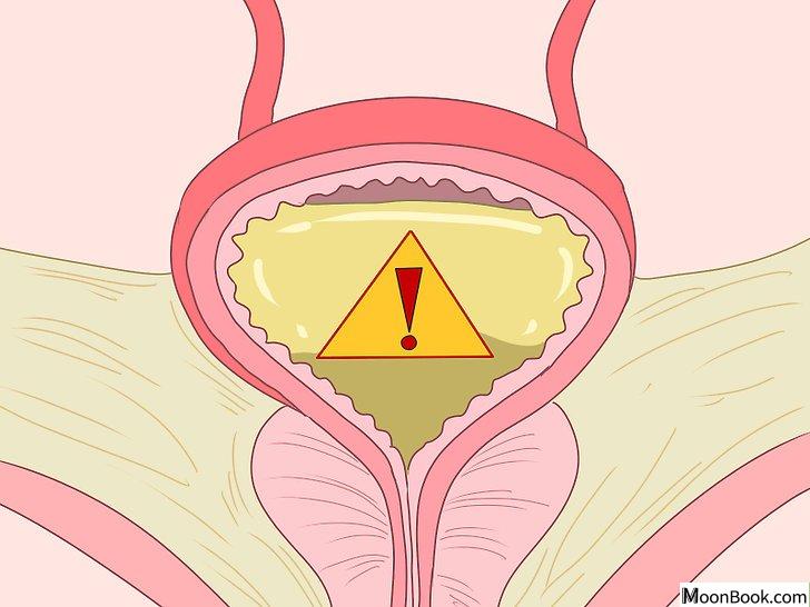 以Reduce Protein in Urine Step 4为标题的图片