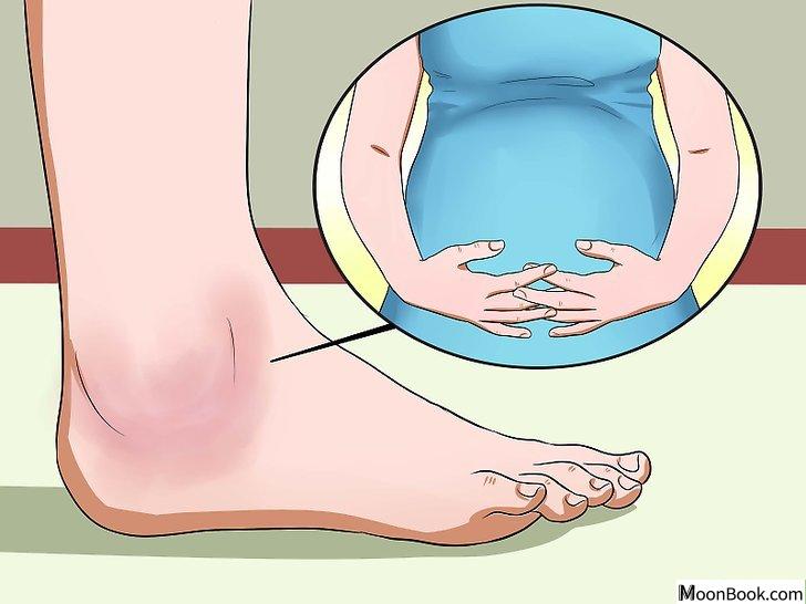 以Soothe a Sore Ankle Step 3为标题的图片