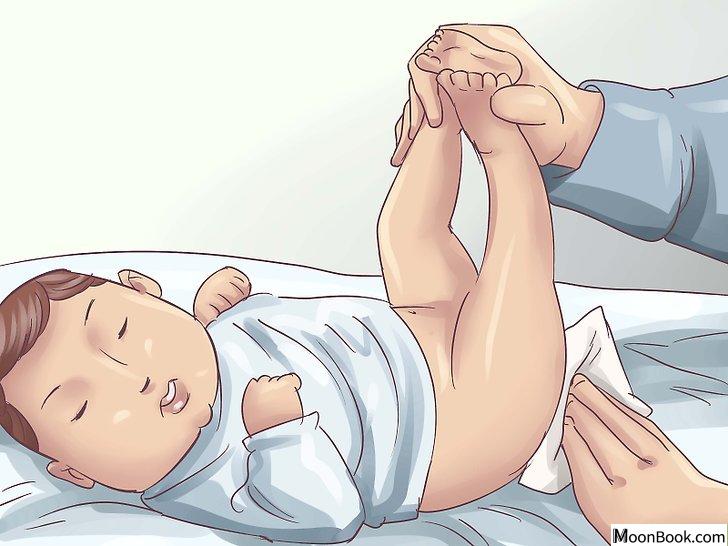 以Treat Diaper Rash Step 1为标题的图片