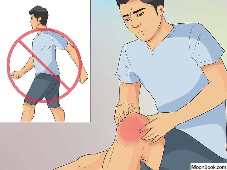 以Treat a Knee Sprain Step 1为标题的图片