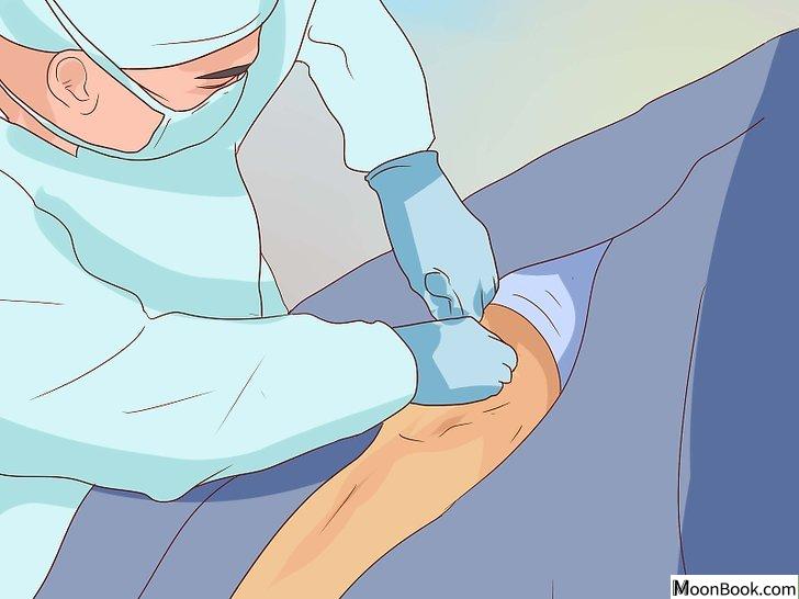 以Treat a Knee Sprain Step 13为标题的图片