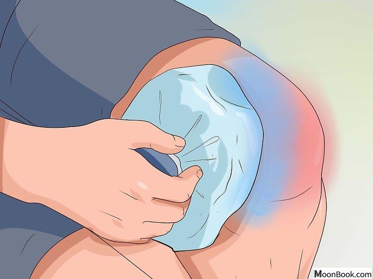 以Treat a Knee Sprain Step 3为标题的图片